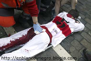 20080127181808-moron-culo-roto.jpg
